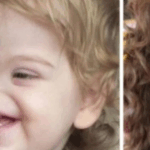 Conoce a una niña nacida sin nariz: Algunos la llaman “Voldemort”, ¡pero en realidad es una niña muy dulce!