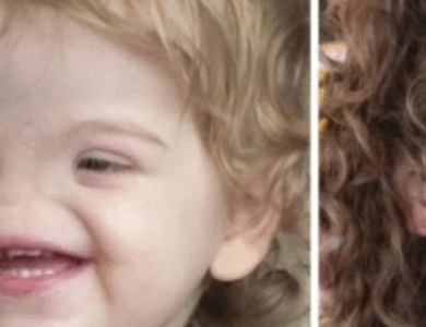 Conoce a una niña nacida sin nariz: Algunos la llaman “Voldemort”, ¡pero en realidad es una niña muy dulce!