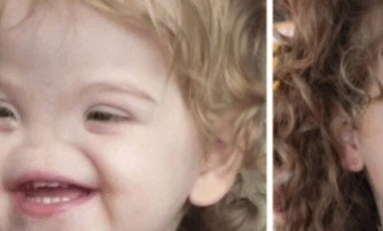 Conoce a una niña nacida sin nariz: Algunos la llaman “Voldemort”, ¡pero en realidad es una niña muy dulce!