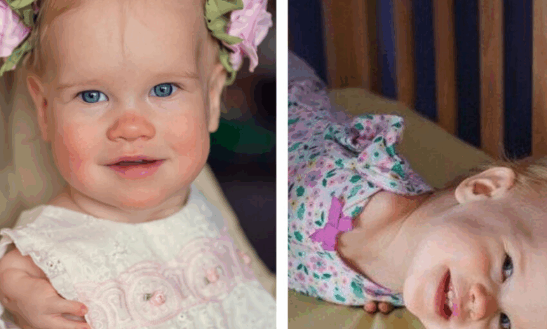 Una familia adoptiva regaló verdadero calor y amor a una niña que nació con particularidades físicas.