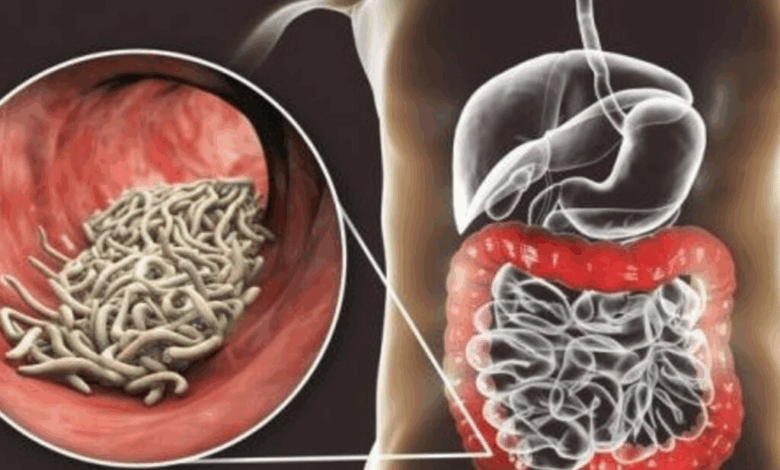 ¿Sabías que podrías tener parásitos sin saberlo?