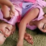 “¡Separados a los 4, Ahora 18 Años Después!”: ¿Cómo Lucen Estos Gemelos Ahora Tras una Cirugía de Separación de 26 Horas?