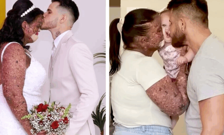 Una mujer es llamada ‘irresponsable’ por tener un bebé con su condición de piel, ella muestra a su ‘hermosa’ pequeña.