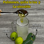 ¿Mocos en los pulmones? ¿Tos seca? ¿Sinusitis? ¿Mocos en los pulmones? ¿Tos seca? ¿Sinusitis?