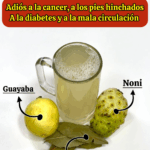 Si tienes pies hinchados, mala circulación, diabetes o grasa en el hígado…