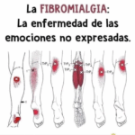 ¿Te duelen los músculos sin razón aparente? Podría ser fibromialgia