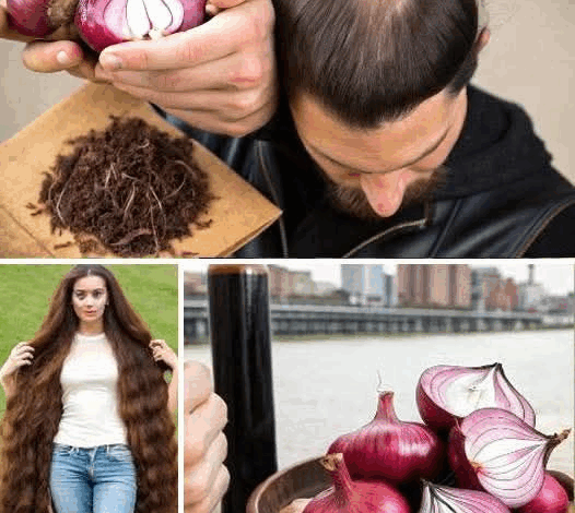Clavo y Cáscara de Cebolla: tu secreto para un cabello fuerte y saludable