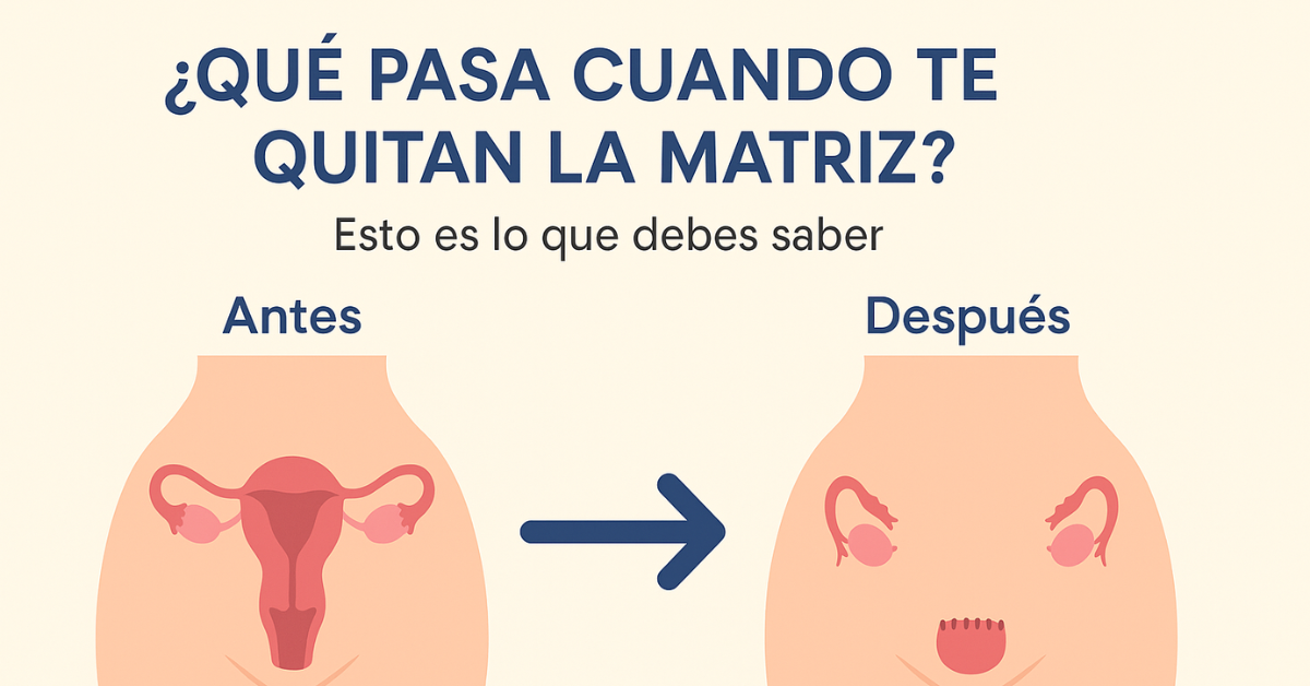 Esto es lo que debes saber ¿Qué pasa cuando te quitan la matriz?