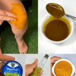 El Remedio Natural Que Alivia el Dolor de Rodilla al Instante El Remedio Natural Que Alivia el Dolor de Rodilla al Instante