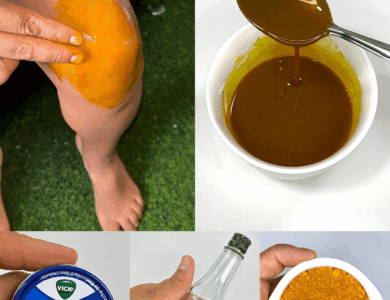 El Remedio Natural Que Alivia el Dolor de Rodilla al Instante