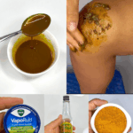 El remedio casero que alivia el dolor de rodillas y espalda de forma rápida y natural