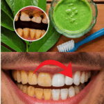 El Sorprendente Secreto de la Abuela para una Sonrisa de Hollywood: ¡Las Hojas de Guayaba Reveladas! El Sorprendente Secreto de la Abuela para una Sonrisa de Hollywood: ¡Las Hojas de Guayaba Reveladas!