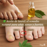 Laurel para Hongos en las Uñas: Remedio Natural y Efectivo