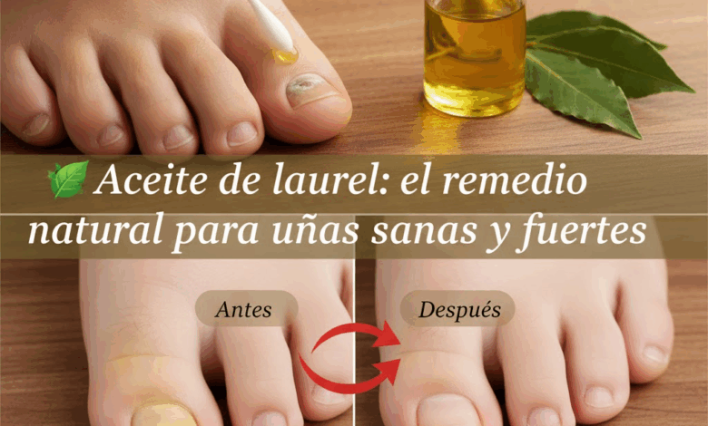 Laurel para Hongos en las Uñas: Remedio Natural y Efectivo