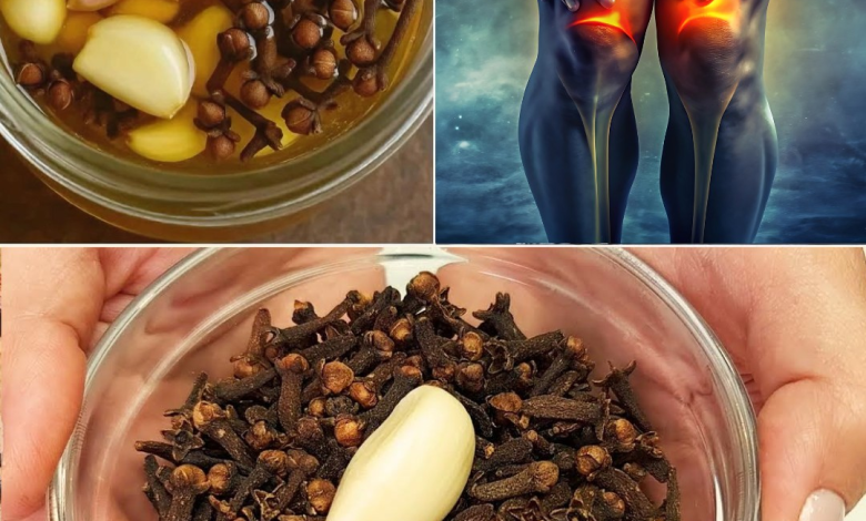 Ajo y Clavos de Olor: El Remedio Casero que Está Transformando las Várices y la Salud Circulatoria