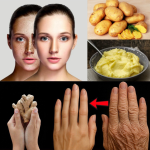 Mascarilla de Papa y Jengibre: El Remedio Natural para Aclarar Manchas, Suavizar Arrugas y Rejuvenecer tu Piel