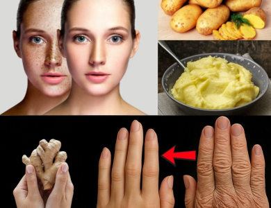 Mascarilla de Papa y Jengibre: El Remedio Natural para Aclarar Manchas, Suavizar Arrugas y Rejuvenecer tu Piel