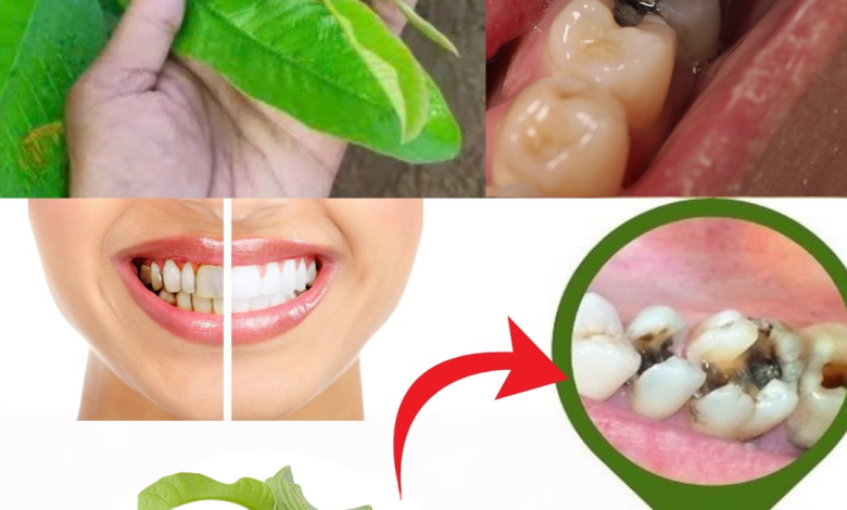 Descubre el Secreto de la Naturaleza: 3 Poderosos Remedios con Hojas de Guayaba para Combatir la Caries Dental
