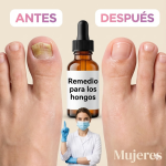 Remedio casero con clavos de olor y limón para los hongos: ¿funciona realmente? Remedio casero con clavos de olor y limón para los hongos: ¿funciona realmente?