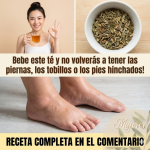 Té para Piernas Hinchadas: Remedio Natural para la Retención de Líquidos y la Mala Circulación Té para Piernas Hinchadas: Remedio Natural para la Retención de Líquidos y la Mala Circulación