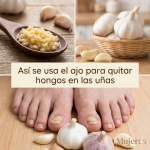 Ajo para Hongos en la Cabeza, Manos, Uñas y Pies: Guía Completa de Uso Natural