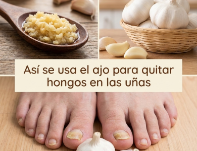 Ajo para Hongos en la Cabeza, Manos, Uñas y Pies: Guía Completa de Uso Natural