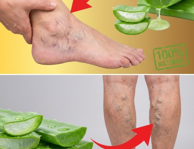 Aloe Vera para Piernas Hinchadas y Cansadas: El Remedio Natural que Tu Cuerpo Agradecerá Aloe Vera para Piernas Hinchadas y Cansadas: El Remedio Natural que Tu Cuerpo Agradecerá