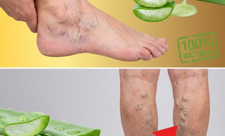 Aloe Vera para Piernas Hinchadas y Cansadas: El Remedio Natural que Tu Cuerpo Agradecerá