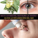 Remedio natural para cataratas e inflamación ocular: cómo apoyar tu visión de forma suave y casera Remedio natural para cataratas e inflamación ocular: cómo apoyar tu visión de forma suave y casera