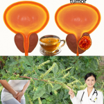 Té Natural para Cuidar la Próstata: Plantas Tradicionales que Apoyan tu Salud Urinaria Té Natural para Cuidar la Próstata: Plantas Tradicionales que Apoyan tu Salud Urinaria