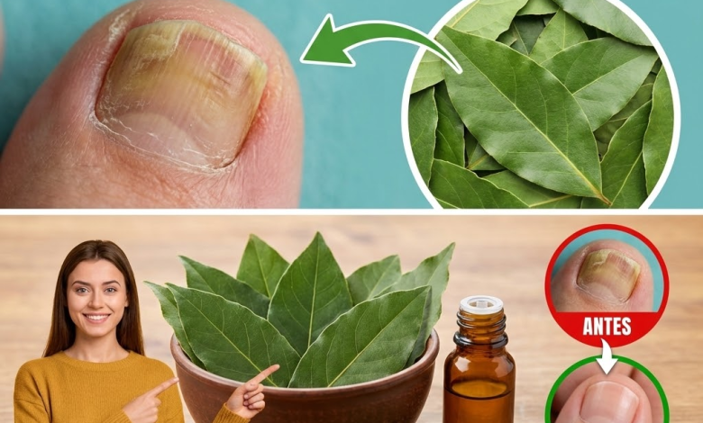 Laurel para hongos en las uñas: cómo usarlo, beneficios y precauciones
