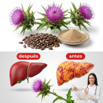 Cardo mariano: la “medicina gratuita” que protege tu hígado y tu salud Cardo mariano: la “medicina gratuita” que protege tu hígado y tu salud